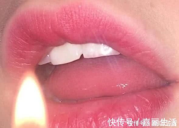 口腔|最伤“嘴唇”的3种水果,全是00后最爱,难怪一直没脱单