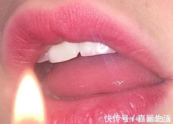 口腔|最伤“嘴唇”的3种水果，全是00后最爱，难怪一直没脱单