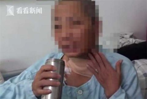 阿姨|阿姨脖子酸痛以为是颈椎病 一查发现竟长了肿瘤