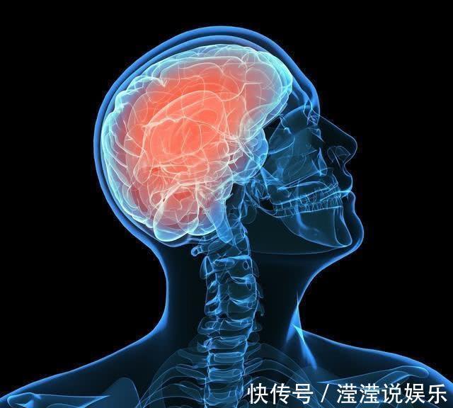 医生|男子突发脑梗，入院就下了病危，医生直言这''习惯''害了不少人