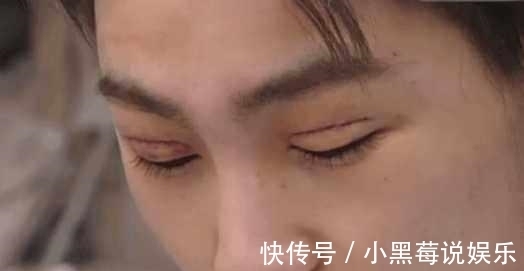 小伙|小伙为了变得更加帅气去割双眼皮,割完之后他的人生都发生了变化