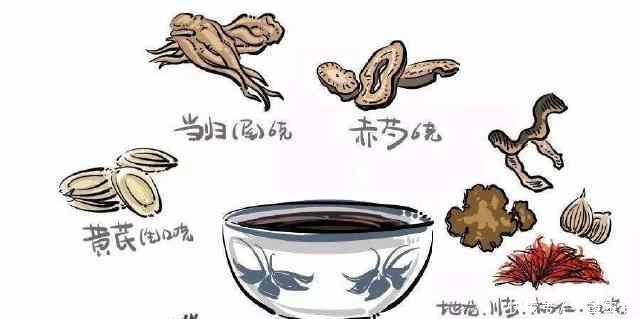 腰痛、腿麻、腿疼可能是腰椎间盘突出,名医王清任的这个方子管用