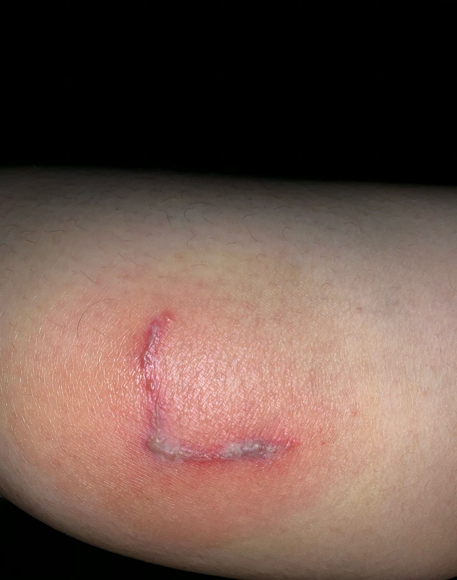 ph值|6岁男孩只因惹了这个小家伙脸部皮肤溃烂。麻烦就在“举手之间”