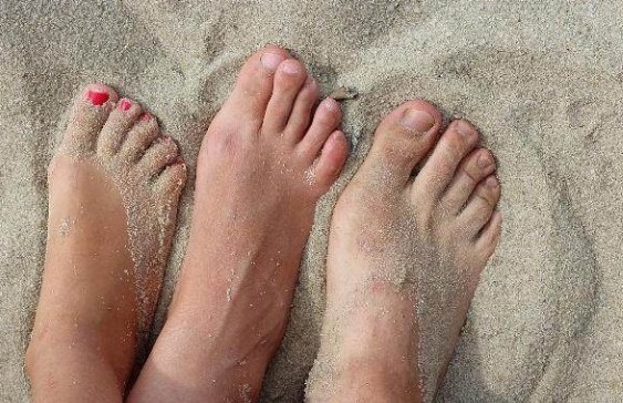 间歇性|“血管堵，脚先知”，若脚上没有4种情况，说明血管依旧“年轻”