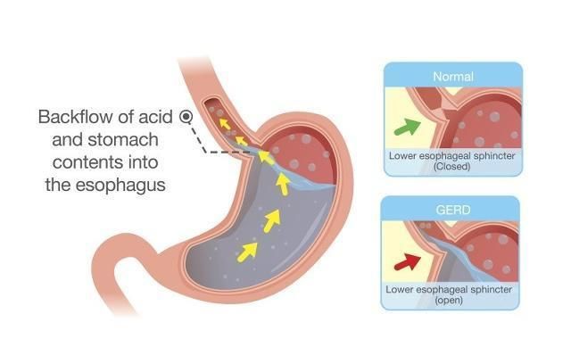 男性晨起常吃醋泡生姜，或許這些好處不請自來，不妨自測你占幾個