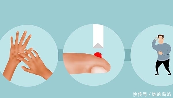 想降血糖,吃粗粮管用吗?降糖吃哪些食物比较好?听医生讲