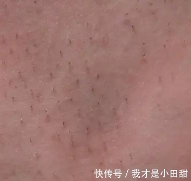 夫妻俩|儿子身上长满了“毒刺”,父母慌忙带到医院检查,医生:愚昧!