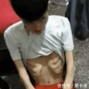 检查|17岁男孩瘦到40斤,去医院检查没病,他含泪道出事情真相