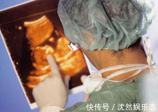 喝水|孕妈这些坏习惯，可能导致羊水变浑浊，拖到第三级，只能终止妊娠