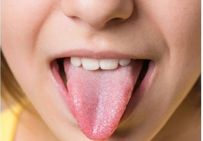 癌症舌头有什么症状 癌症舌头有什么症状