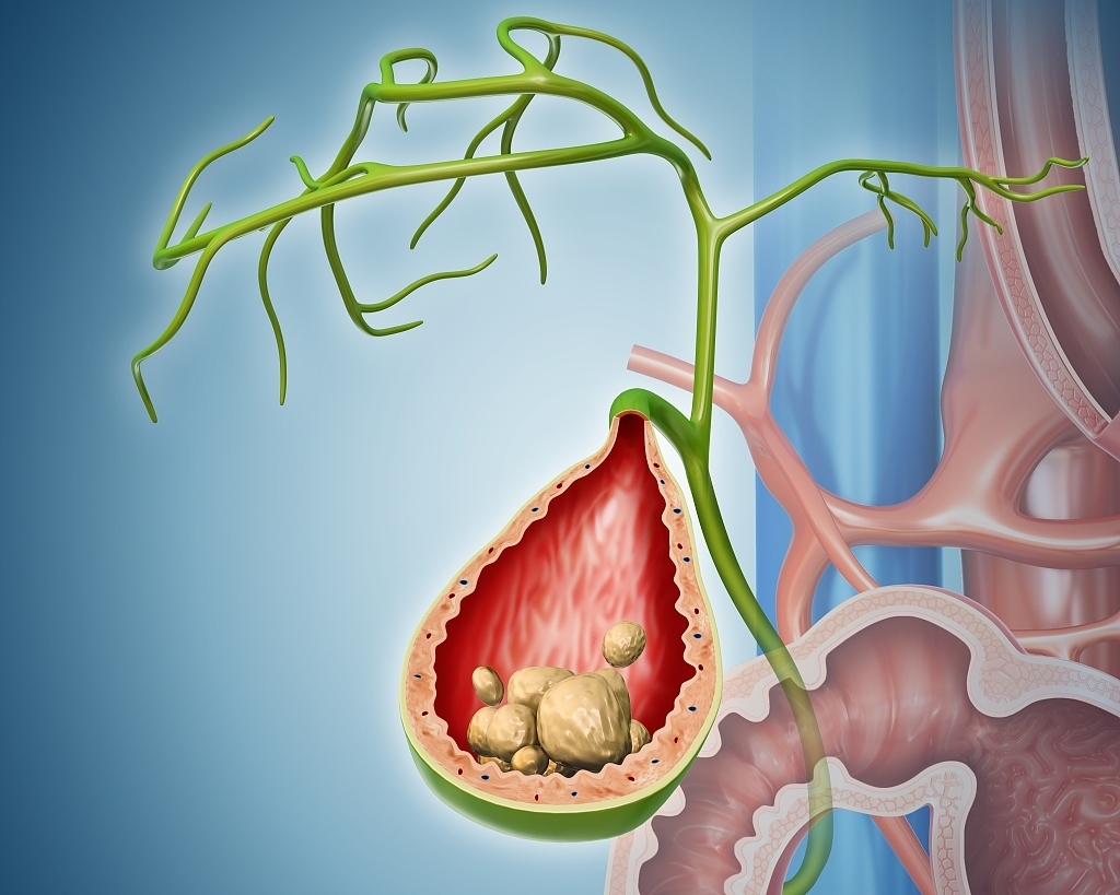 身体健康|为了身体健康，我们应该少吃肉事实并非如此，但5种肉要少吃