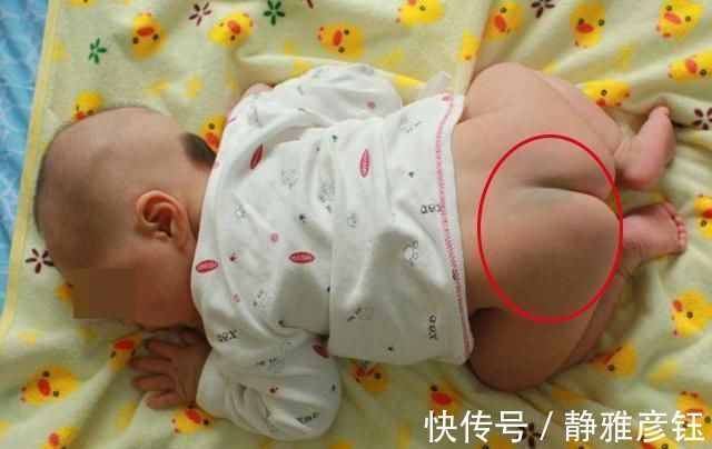 理论|发现新生儿小屁屁上有“淤青”,老公想找护士理论,最后暗暗庆幸