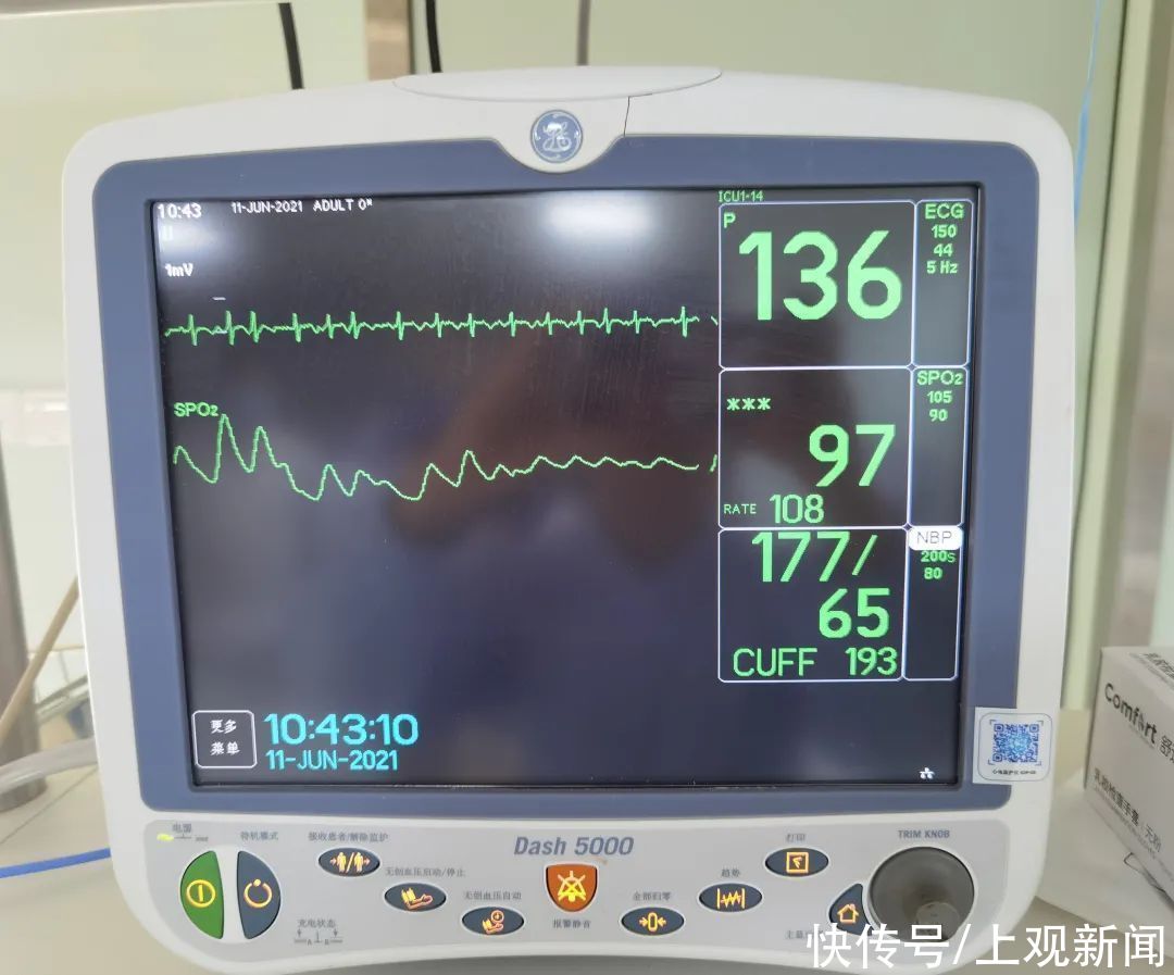 抢救|紧急支援 生死时速——一位过敏性休克患者的抢救全纪录