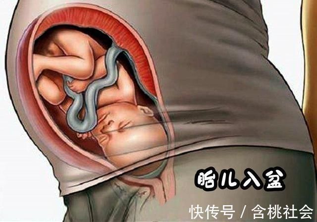 分娩|孕36周后,孕妈有这2种怪怪的“变化”,恭喜你,是胎儿入盆了