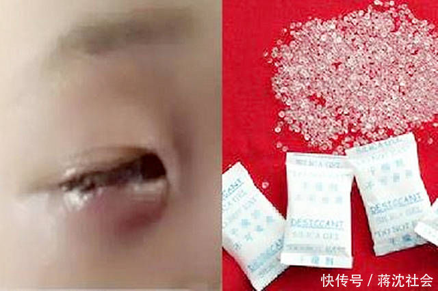 小皇帝|4岁外孙误食一袋干燥剂,姥姥这个动作救了娃,医生:比我高明