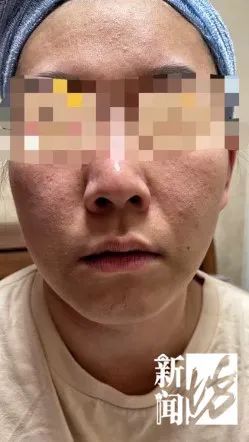 干细胞|别拿脸开玩笑!沪上一女子在美容院“做脸”,却越做越没脸见人…
