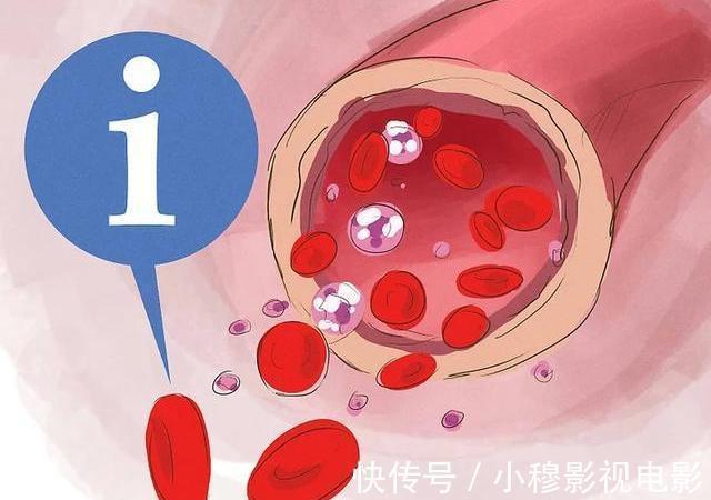 不适感|血脂高的人,身体会有3种“异常”,或在暗示你,血脂已经超标