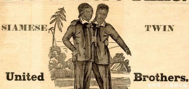 马戏团|泰国连体兄弟,在美国马戏团打拼10年,迎娶两姐妹,生了21个孩子