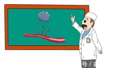 癌症|肿瘤医生:癌症再次复发,多半与几个因素有关,要引起警惕