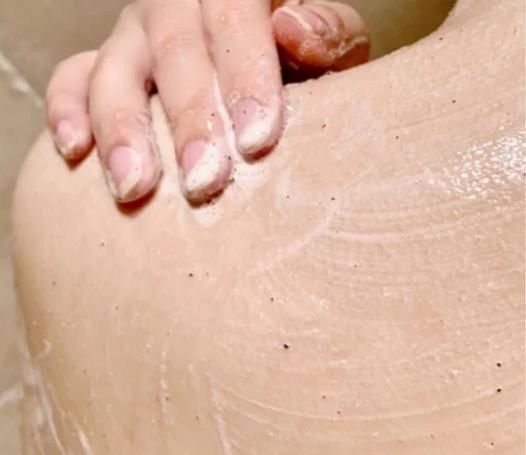 手臂和小腿容易有鸡皮日常做好4点,鸡皮离你远远的