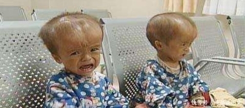 孩子|10年过去了,曾经喝过三鹿奶粉的孩子,如今变成这个样子!