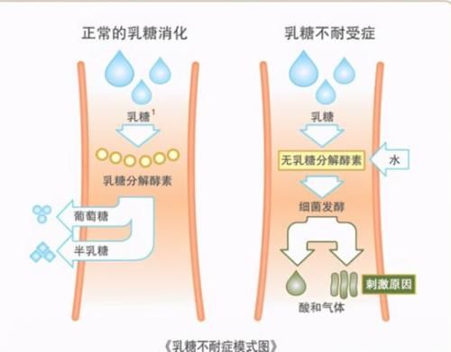 肠道|医生总结：这2类人不适合多喝牛奶，请管住自己的嘴