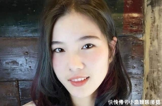 防止“发际线”变高，这3种发型千万别留，第2种平时最常见！