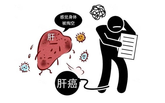 筛查|癌症多是“拖”出来的？体检不查4个部位，癌症缠身都不自知！