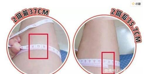 女生|建议“腿粗”女生,分清肌肉腿和水肿腿再坚持这样做,想不瘦都难