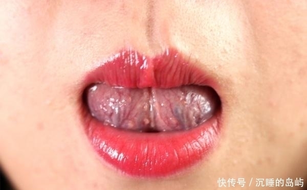 舌头|身体出了问题,舌下“青筋”会告诉你,这几个信号多注意
