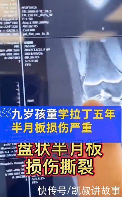 萱萱|4岁孩子一个动作导致高位截瘫！6岁以前别轻易给孩子报这些兴趣班