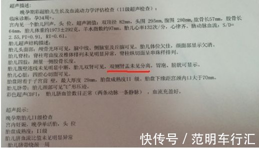 小秘密|孕检单上的“小秘密”,孕检单上出现这种结果时,恭喜您已知答案