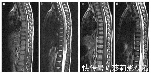 舞蹈|医生的孩子,为啥都不去学舞蹈?这可能是孩子圈的潜规则