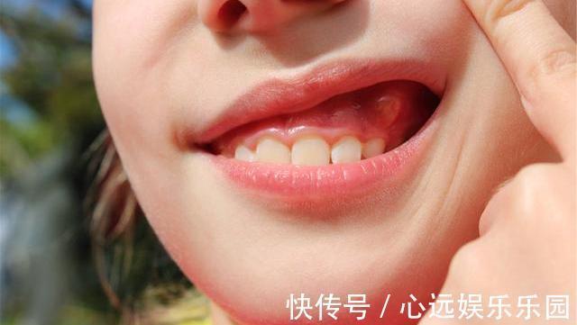 营养物质|常喝枸杞水养肝强身,但要避开四个禁忌,为了健康,花时间看看吧