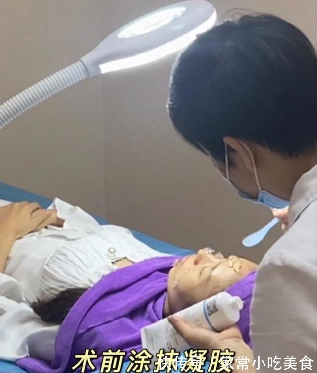 光子嫩肤 Dpl光子嫩肤效果怎么样!