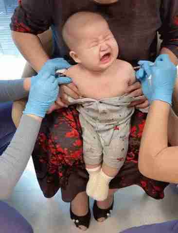 双管齐下|宝宝注射疫苗“双管齐下”,哭都不知道脸看哪边,可以一次两针?