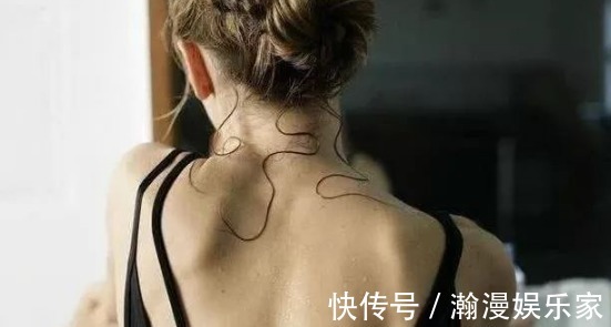 奥地利|螨虫堵塞背后毛孔时,会出现4个明显特征!来学3招除螨