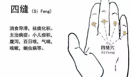 四缝穴，扎一次见效，二次痊愈，真是绝了