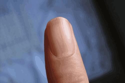 竖纹|指甲变成这样,预示大病很快来临,赶紧重视起来吧!