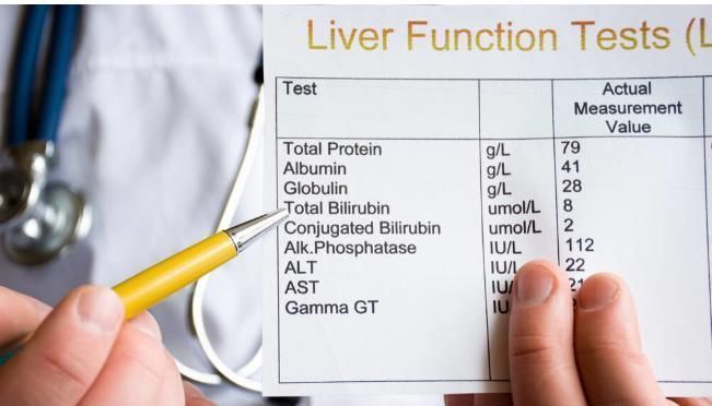 脂肪肝|肝功能检查前,若不注意4点,检查结果将成为废纸,白白费钱了