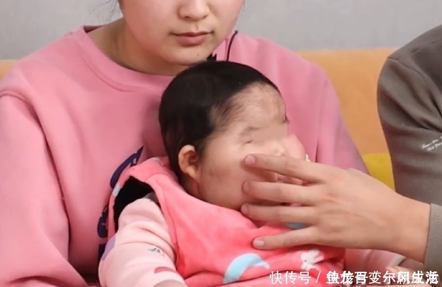 汗毛|“大头娃娃”事件卷土重来：这款婴儿霜激素超标，请家长赶快自查