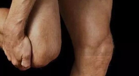 慢性滑膜炎|送你3种方法,10天巧治膝盖疼,连滑膜炎也一起消失了