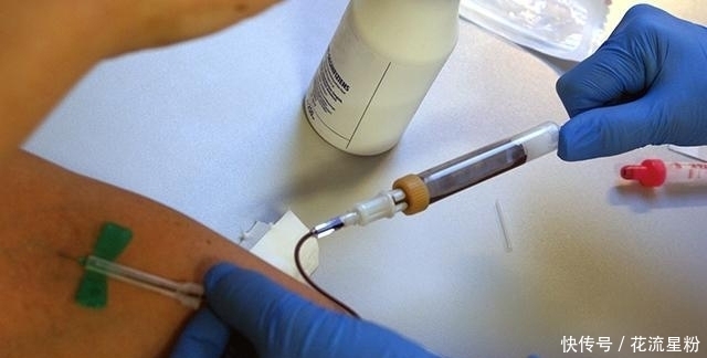 检查|身上一处经常流血,可能肝炎已不是早期,再加上失眠更得小心