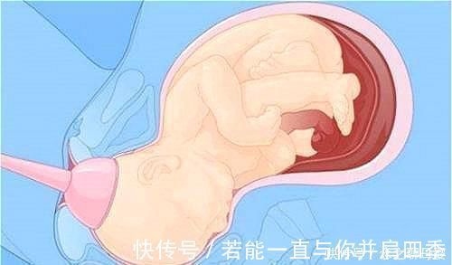 产妇|顺产宝宝是怎么“生”的一组图带你了解全过程,妈妈其实不孤单