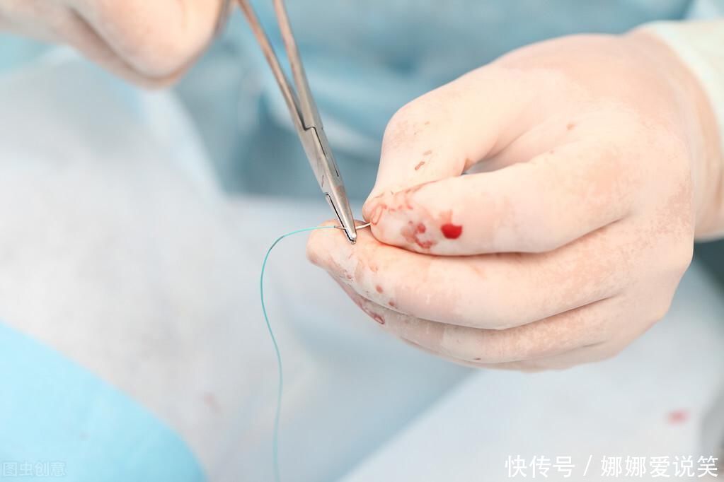 小宝|孩子误吞硬币、意外受伤该怎么办？儿科医生提醒：这样做才正确