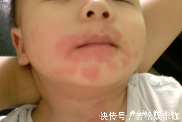 蛋清|为什么最好别给宝宝吃“鸡蛋羹”?儿科医生劝诫数次,家长仍乱来