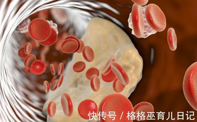 糖尿病人|常吃粗粮有助降血糖?内科医生:这3种粗粮高升糖,糖尿病人少吃