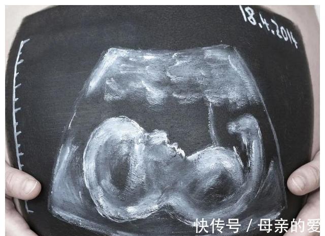 准妈妈|胎动——胎宝宝健康与否的重要指标,它的秘密你知道多少呢?