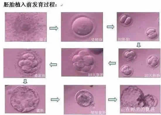 胚胎|【孕育新生】“试管婴儿”在胚胎实验室里的变化