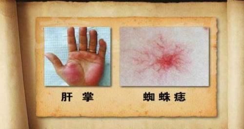  养肝|天然的“养肝王”找到了，不是枸杞和大蒜，你若爱吃，肝日益变好